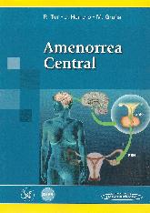 Amenorrea Central