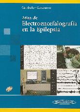 Atlas de Electroencefalografa en la Epilepsia