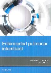 Enfermedad Pulmonar Intersticial