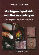 Colagenopatas en Dermatologa