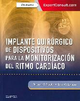 Implante Quirrgico de Dispositivos para la Monitorizacin del Ritmo Cardiaco