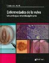 Enfermedades de la vulva. Un enfoque interdisciplinario