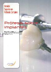 Prtesis sobre implantes