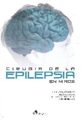 Ciruga de la epilepsia en nios