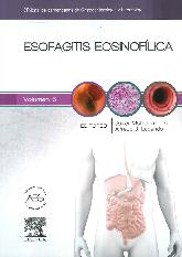 Esofagitis Eosinoflica