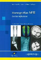 Monografas SER. Artritis Infecciosa