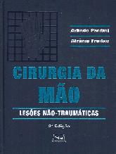 Cirugia da Mo  Leses No . Traumticas