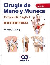 Ciruga de mano y mueca