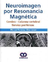 Neuroimagen por resonancia magntica