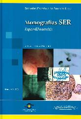 Monografas SER Espondiloartritis