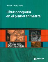 Ultrasonografa en el primer trimestre