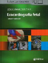 Ecocardiografa Fetal