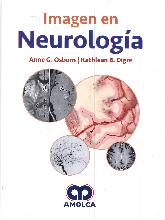 Imagen en neurologa