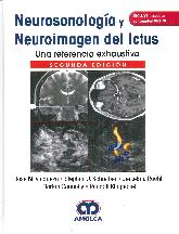 Neurosonologa y neuroimagen del ictus