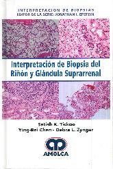 Interpretacin de Biopsia del Rin y Glndula Suprarrenal