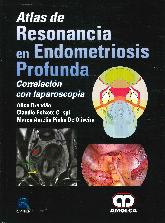 Atlas de Resonancia en Endometriosis Profunda