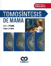 Tomosntesis de la mama