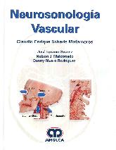 Neurosonologa Vascular