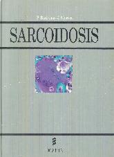 Sarcoidosis