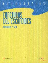 Fracturas del escafoides