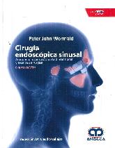 Ciruga Endoscpica Sinusal