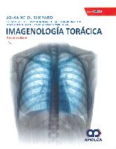 Imagenologa Torcica