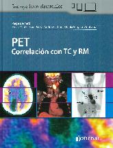 PET Correlación con TC y RM