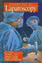 Essential of Laparoscopy