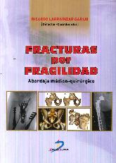 Fracturas por Fragilidad