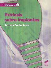 Prtesis sobre implantes