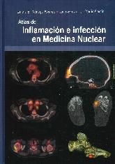 Atlas de Inflamacin en Infeccin en Medicina Nuclear