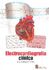Electrocardiografa Clnica