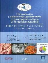 Citorreduccin y quimioterapia perioperatoria en las neoplasias malignas de la superficie peritoneal