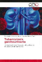 Tuberculosis genitourinaria