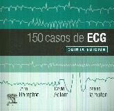 150 Casos de ECG