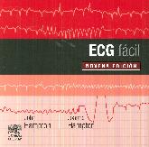 ECG fcil