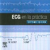 ECG en la Prctica