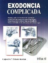 Exodoncia Complicada