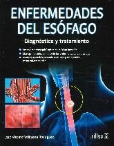 Enfermedades del esfago. Diagnstico y tratamiento