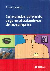 Estimulacin del nervio vago en el tratamiento de las epilepsias