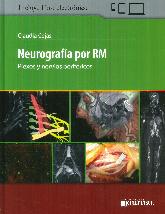 Neurografa por RM
