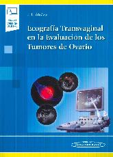 Ecografa Transvaginal en la Evaluacin de los Tumores de Ovario