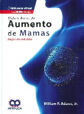 Video Atlas de Aumentos de Mamas