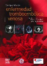 Compendio de enfermedad tromboemblica venosa