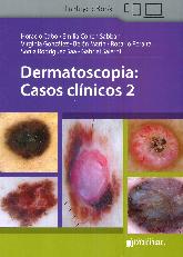 Dermatoscopia: Casos clnicos 2