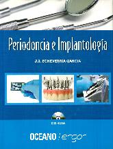 Periodoncia e Implantologa 