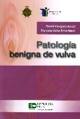 Patologa Benigna de la Vulva