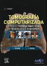 Tomografa computarizada