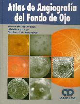 Atlas de angiografa del Fondo de Ojo