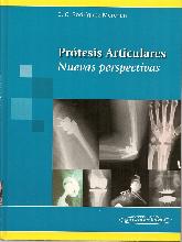 Protesis articulares